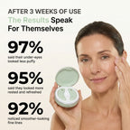 Red Light Under-Eye Reset
