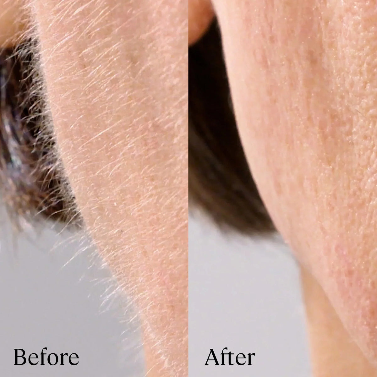 Silk Glide™ 2-in-1 Facial Hair Remover & Eyebrow Trimmer
