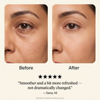 Red Light Under-Eye Reset